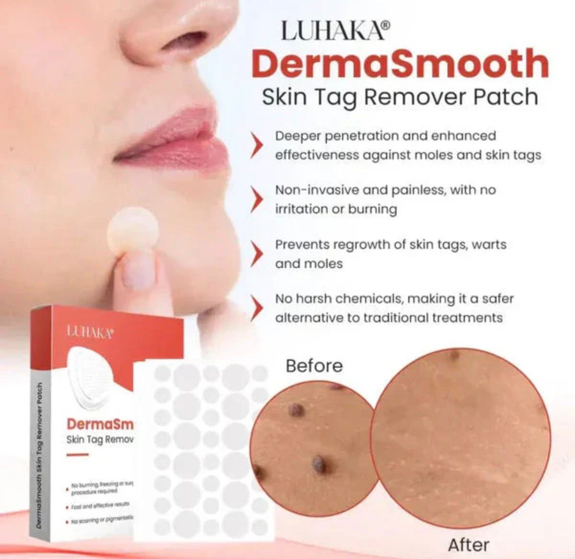 Derma Smooth Skin Tag Removal Patch - 72 Patches