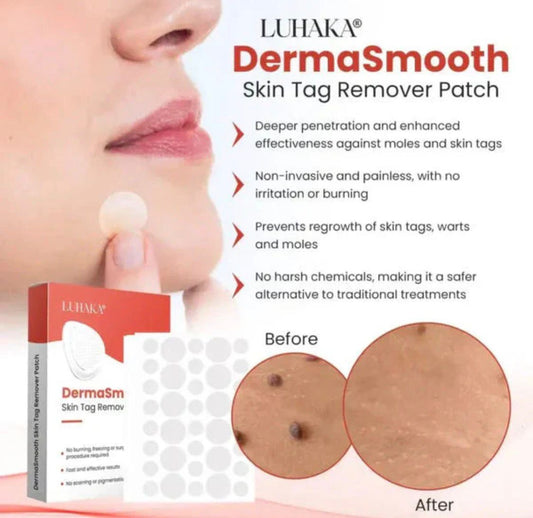 Derma Smooth Skin Tag Removal Patch - 72 Patches