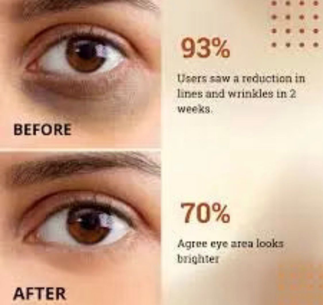 Glowrify Eyelight Serum Dark Circle Remover Around Puffy Eyes 15 ML