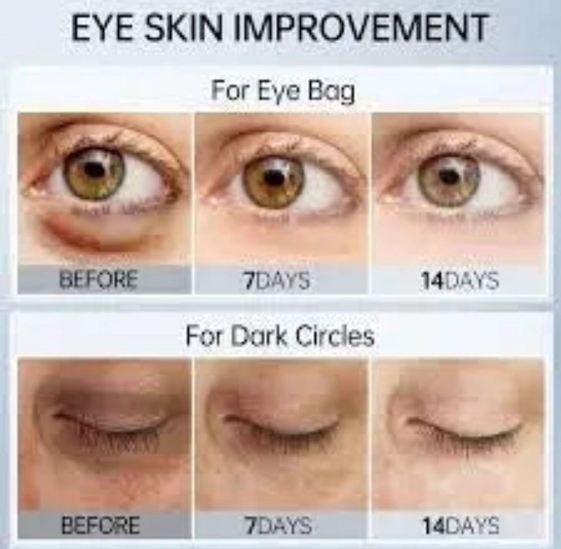 Glowrify Eyelight Serum Dark Circle Remover Around Puffy Eyes 15 ML